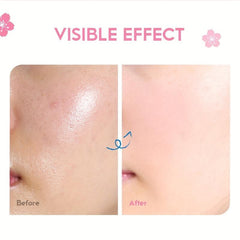 Japanese Sakura Facial Essence Serum for Hydration and Rejuvenation 25g