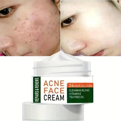 Herbal Tea Tree Face Cream for Acne Marks & Pits Fade