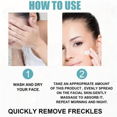 Dark Spot Remover Cream for Face Freckle & Sun Spot Blemish Reducer