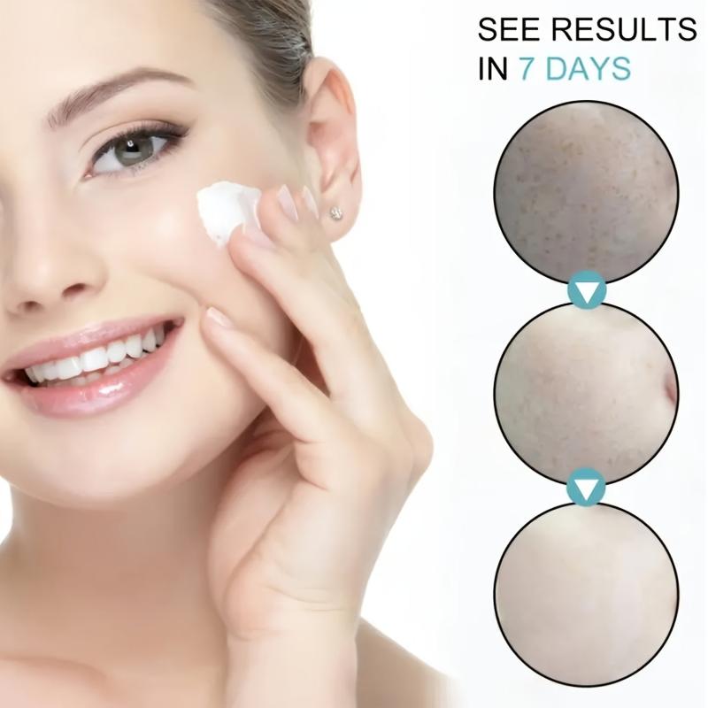 Dark Spot Remover Cream for Face Freckle & Sun Spot Blemish Reducer