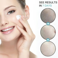 Dark Spot Remover Cream for Face Freckle & Sun Spot Blemish Reducer