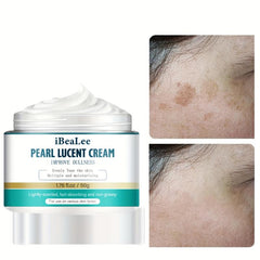 Dark Spot Remover Cream for Face Freckle & Sun Spot Blemish Reducer