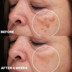 Dark Spot Remover For Face And Body Moisturizes Smooth Repairs Skin