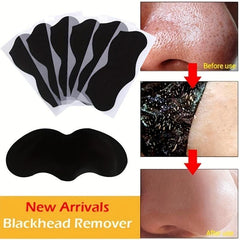 20 Pcs Blackhead Strips Charcoal Pore Remover Deep Nose Cleansing