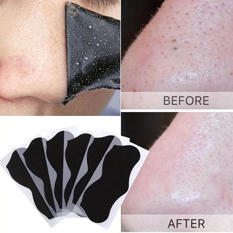 20 Pcs Blackhead Strips Charcoal Pore Remover Deep Nose Cleansing