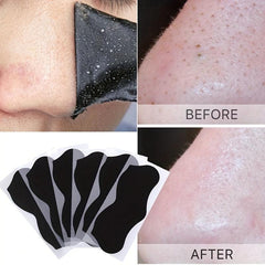 20 Pcs Blackhead Strips Charcoal Pore Remover Deep Nose Cleansing