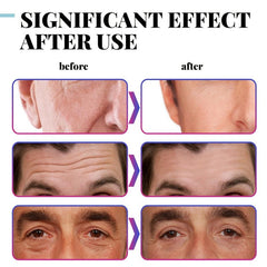 Retinol Face Cream Collagen & Hyaluronic Acid