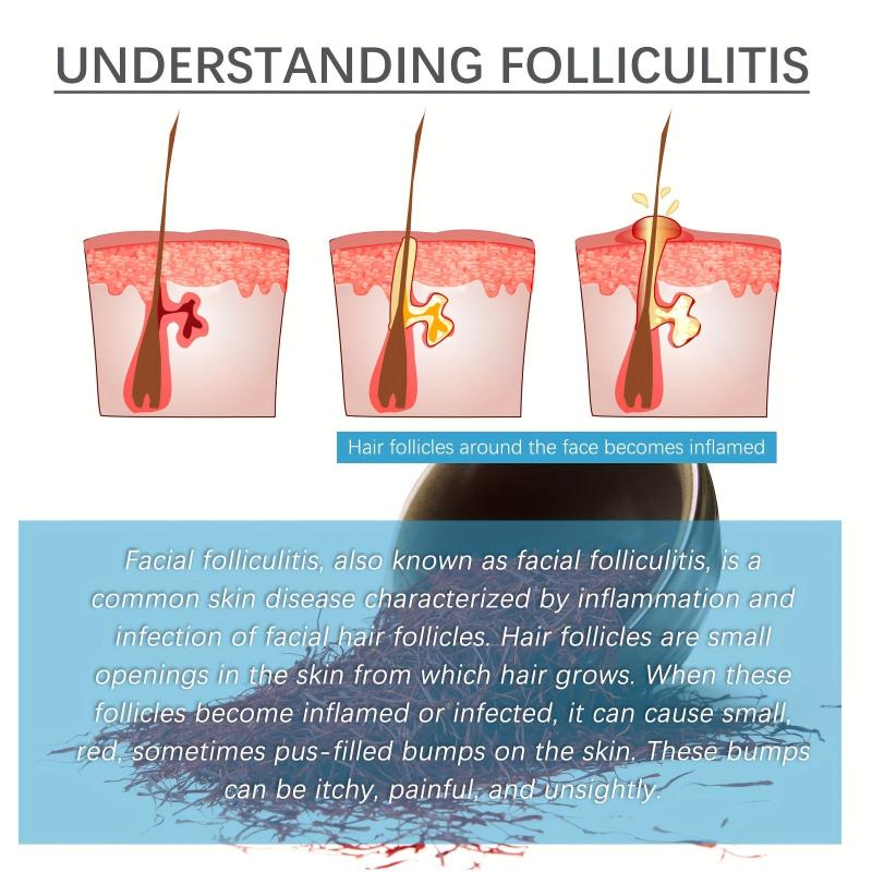 Hair Follicle Repair Cream 20g Moisturizes Itchy Skin Helps Smoothe Face
