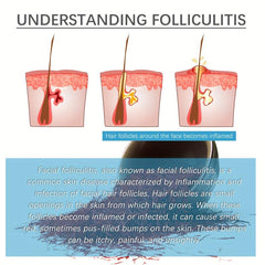 Hair Follicle Repair Cream 20g Moisturizes Itchy Skin Helps Smoothe Face