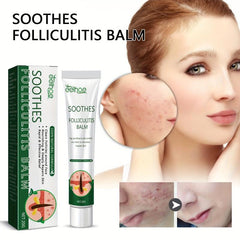 Hair Follicle Repair Cream 20g Moisturizes Itchy Skin Helps Smoothe Face