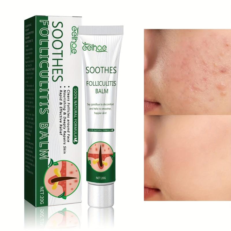 Hair Follicle Repair Cream 20g Moisturizes Itchy Skin Helps Smoothe Face
