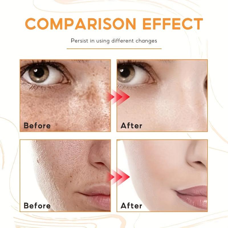 Dark Spot Corrector Cream for Face & Body All Skin Tones