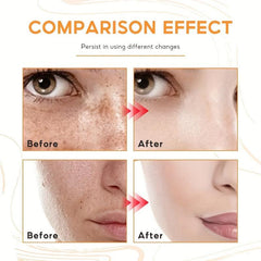 Dark Spot Corrector Cream for Face & Body All Skin Tones