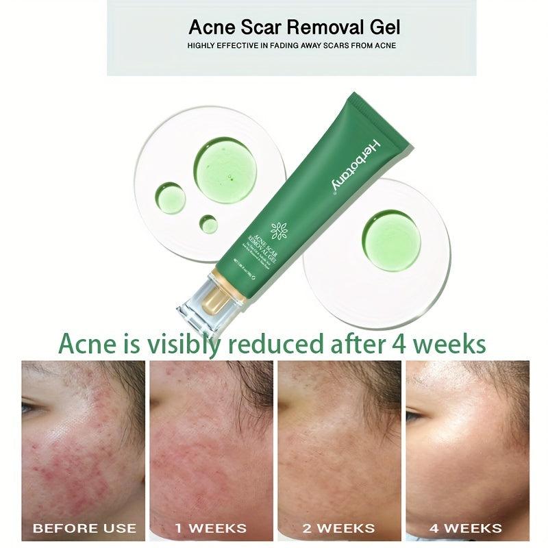 Herbotany Acne Pimple Salicylic Acid Fade Spot Treatment