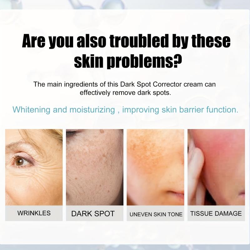 Dark Spot Removal Cream Face Moisturizing Rejuvenation