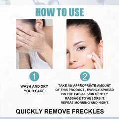 Dark Spot Removal Cream Face Moisturizing Rejuvenation