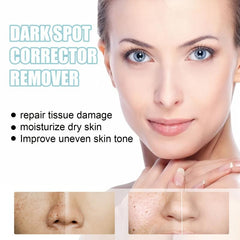 Dark Spot Removal Cream Face Moisturizing Rejuvenation