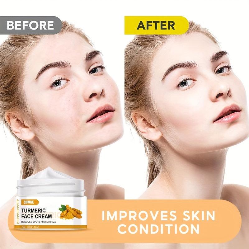 Natural Turmeric Facial Cream Moisturize Deep Cleanse Acne Dark Spots