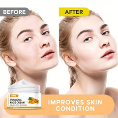 Natural Turmeric Facial Cream Moisturize Deep Cleanse Acne Dark Spots