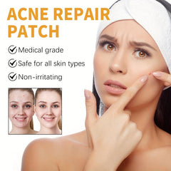 Invisible Acne Concealer Stickers 10 Patches Box