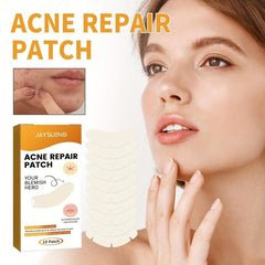 Invisible Acne Concealer Stickers 10 Patches Box