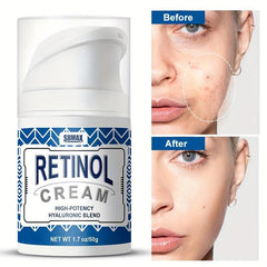 Retinol Cream Moisturizer for Face & Neck - Anti-Wrinkle & Hydrating Formula