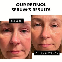 Retinol Collagen & Hyaluronic Acid Double Chin Reducer & Night Cream