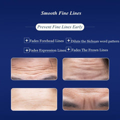 Men's Forehead Wrinkle Patches