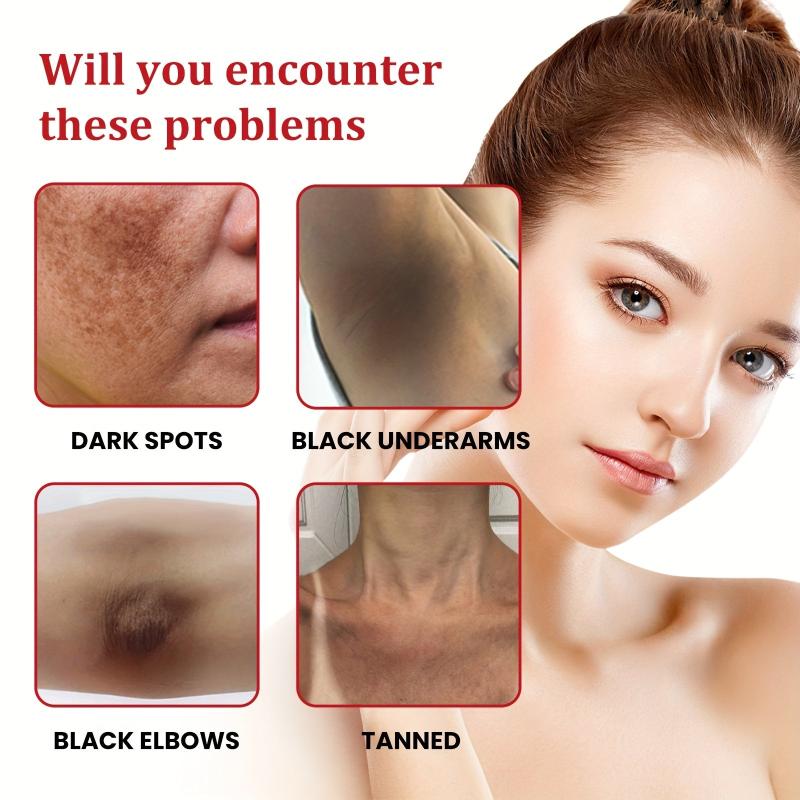 30ml Freckles Cream Dark Spots Melanin Brighten Nourish Skin Care
