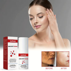 30ml Freckles Cream Dark Spots Melanin Brighten Nourish Skin Care