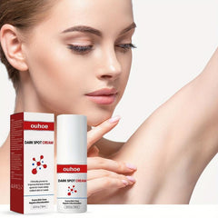 30ml Freckles Cream Dark Spots Melanin Brighten Nourish Skin Care