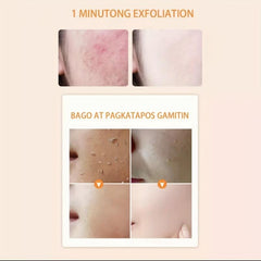 Moisturizing Exfoliating Gel for Face & Body