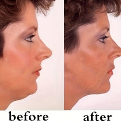 40 Pcs Invisible Face Lift Tapes V-Shaped Face Lift Tape