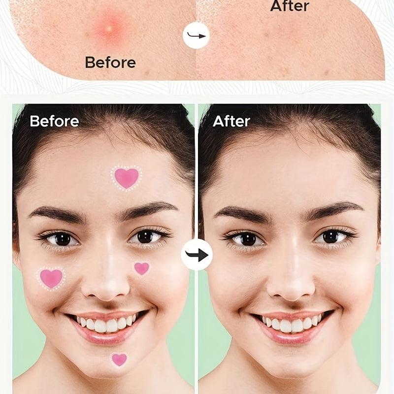 Heart Acne Pimple Patch - Invisible Spot Sticker