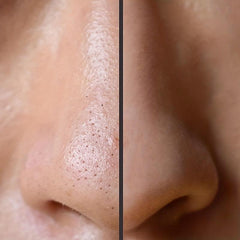 3Pcs Deep Cleansing Nose Strips Blackheads Removal Pore Refining Strips