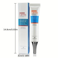 Hydrating Acne Removal Cream for Clear Skin
