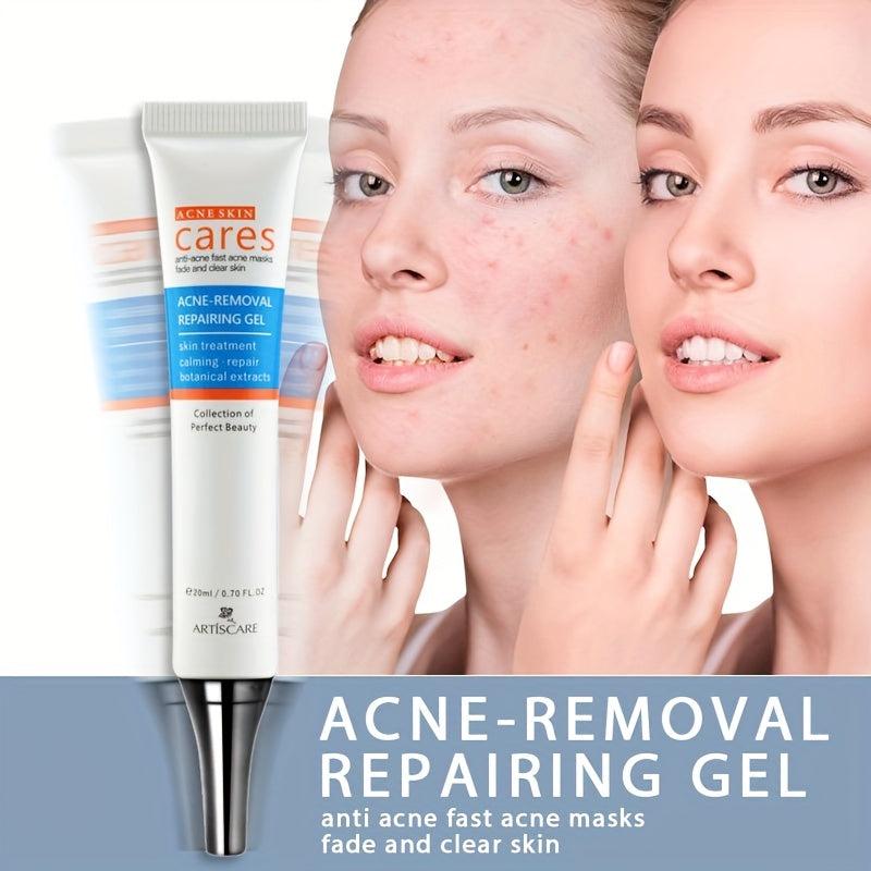 Hydrating Acne Removal Cream for Clear Skin