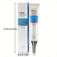 Hydrating Acne Removal Cream for Clear Skin