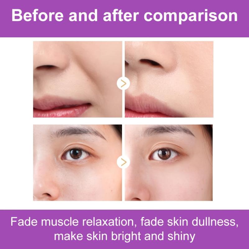 Smooth Nasolabial Folds Mask Reduce Aging Fine Wrinkles