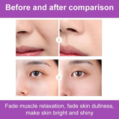 Smooth Nasolabial Folds Mask Reduce Aging Fine Wrinkles