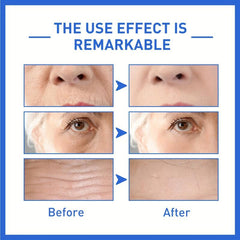 Botox Face Serum Instant Lift Dark Spot Corrector 30ml