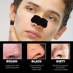 Men's Blackhead Patch Tightens Pores Nose Acne Blackheads Cleanses Shrinks