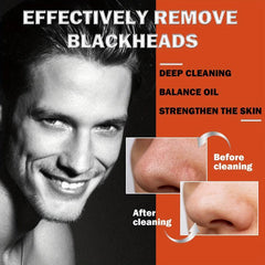 Men's Blackhead Patch Tightens Pores Nose Acne Blackheads Cleanses Shrinks