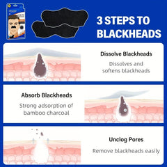 10 Pcs Charcoal Blackhead Pore Strips Remove Blackheads Deep Cleansing Strips