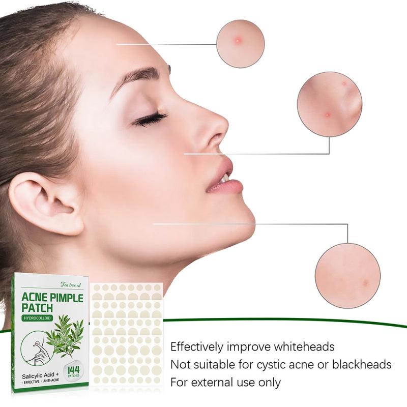 Acne Pimple Patches Non Irritating Spot Stickers Daily Night Acne Remover