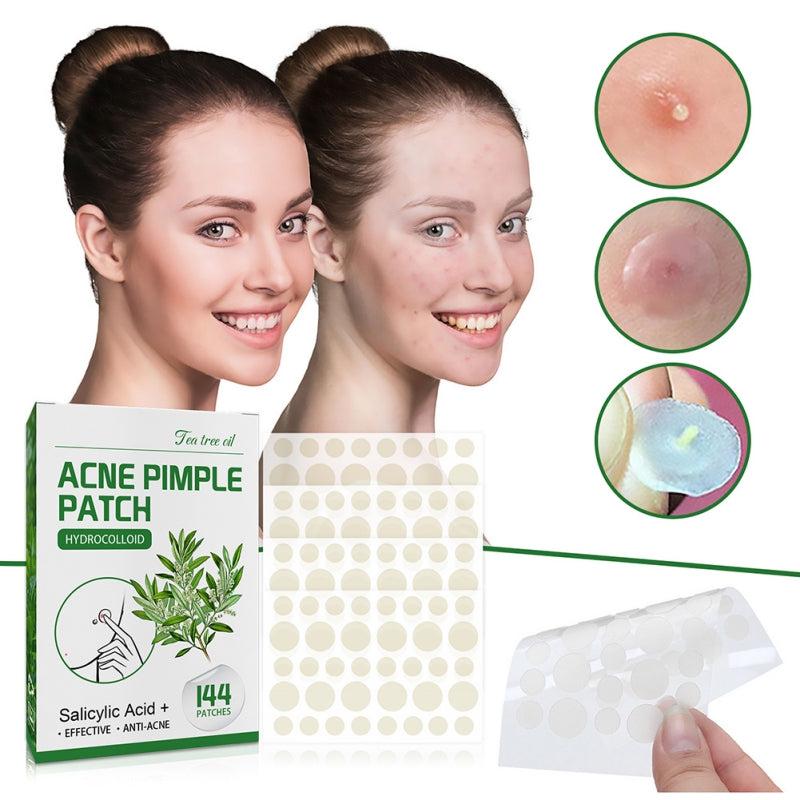 Acne Pimple Patches Non Irritating Spot Stickers Daily Night Acne Remover