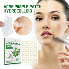 Acne Pimple Patches Non Irritating Spot Stickers Daily Night Acne Remover
