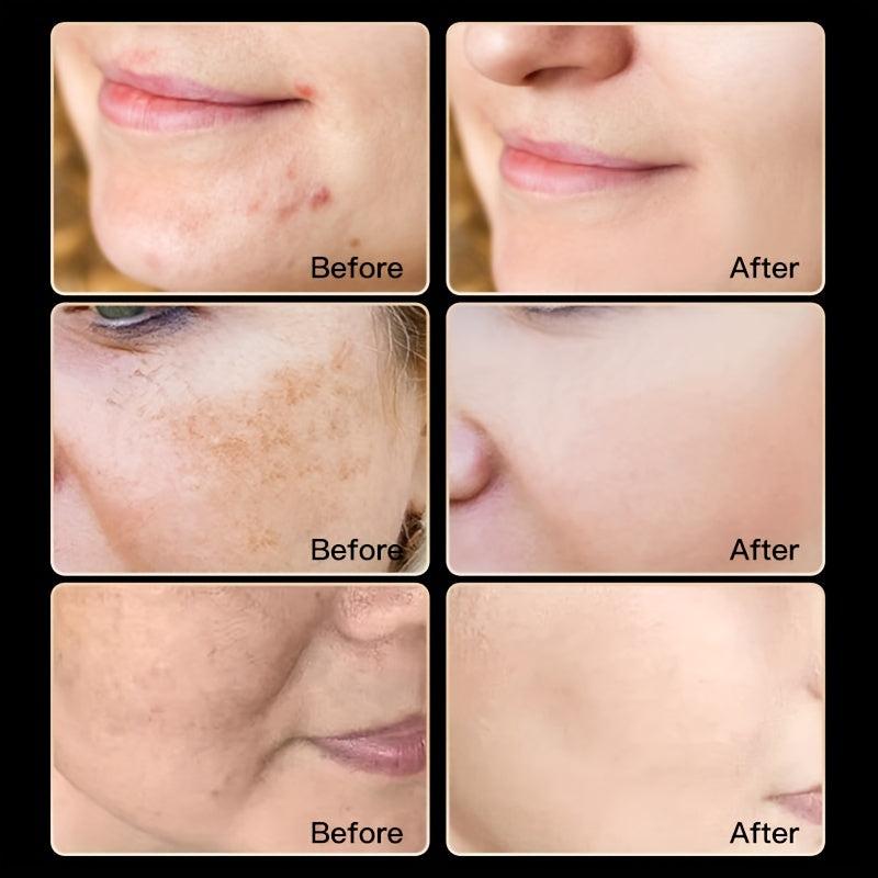 Vit C Whitening Face Cream with Niacinamide & Hyaluronic Acid