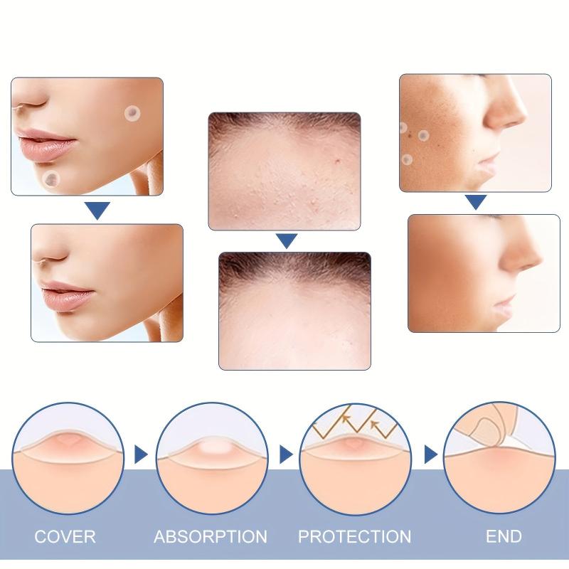 Hydrocolloid Acne Pimple Patches - Cover Pimples & Blemishes