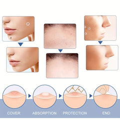 Hydrocolloid Acne Pimple Patches - Cover Pimples & Blemishes
